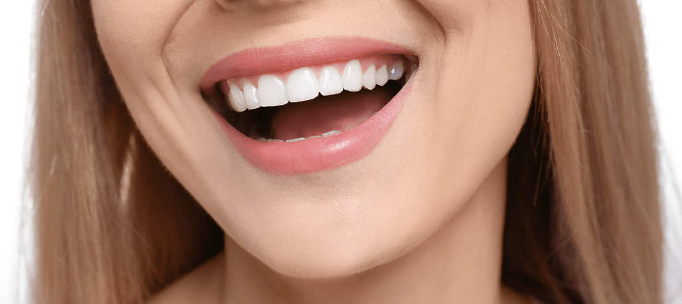 Gülüş Tasarımı (Hollywood Smile) Nedir?