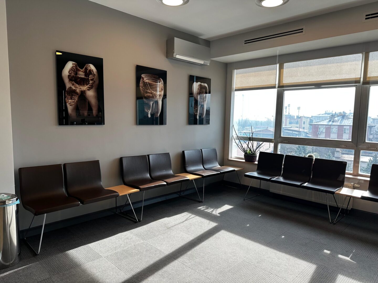 Yüksek teknoloji 3D dental tarayıcı